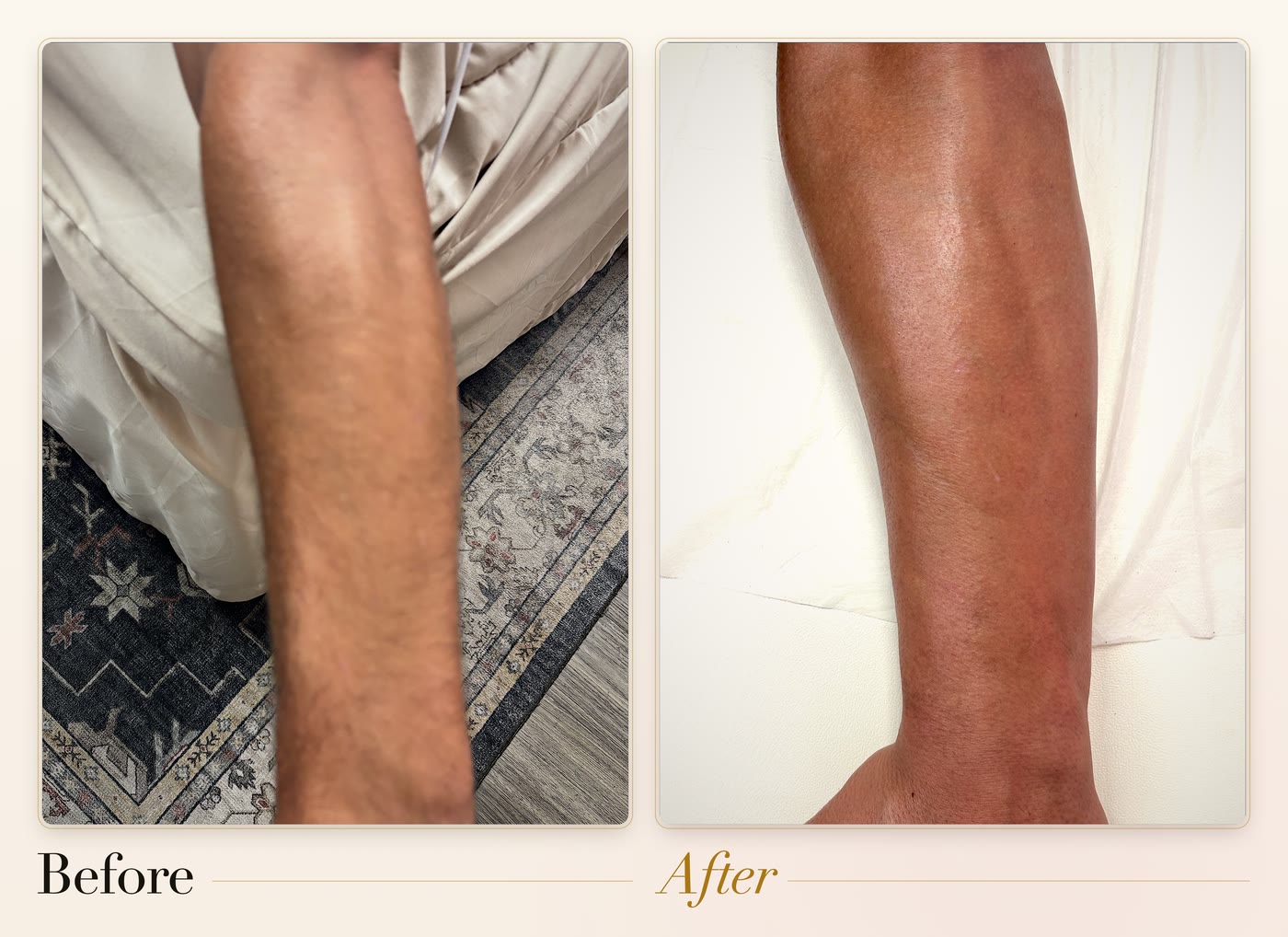 A forearm before and after waxing