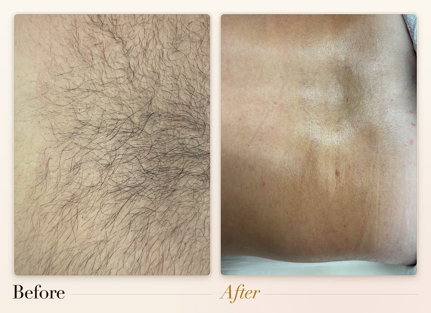A back before and after waxing