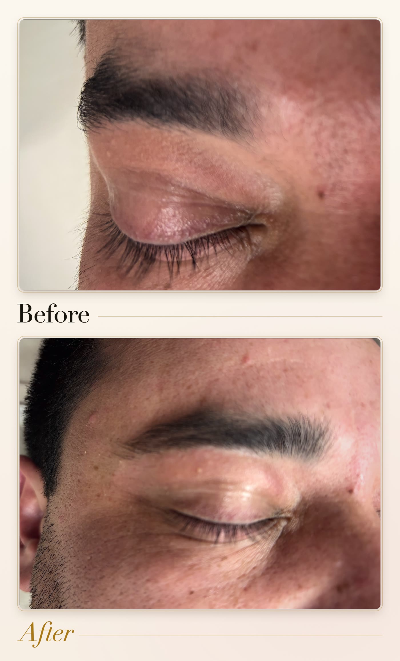 An eyebrow before and after a brow wax