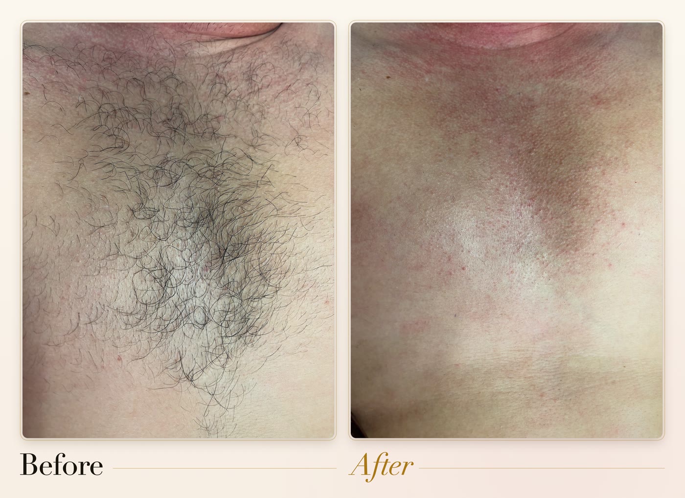 A chest before and after waxing